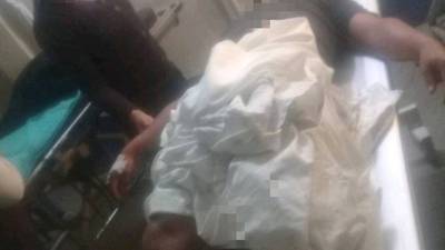 Agente de la PNC resulta herido mientras trasladaba papeletas en Sololá