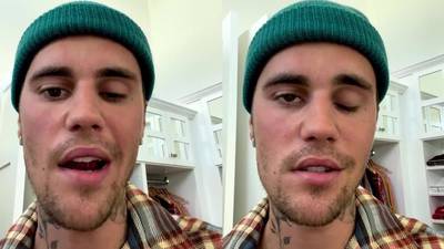 Justin Bieber sufre parálisis facial producto de un virus