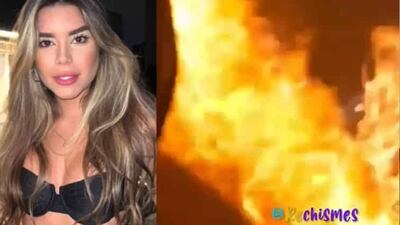 Exreina de belleza quedó cubierta en llamas tras sufrir accidente en un bar