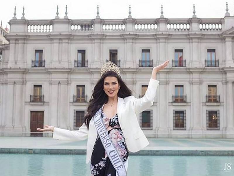 Con fotos de las cicatrices en su rostro, Miss Chile 2018 reveló su trágica historia