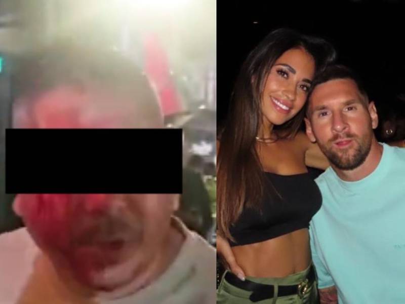 VIDEO. Primer escándalo de Messi en Miami deja a hombre ensangrentado