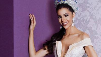 Miss Venezuela estalla tras filtrarse fotos "antes de sus cirugías"