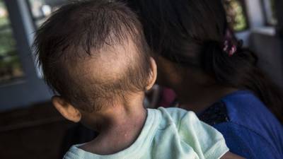 Casi la mitad de la niñez en Guatemala sufre de desnutrición