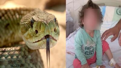 Niña de 2 años mata a mordidas a una serpiente que la mordió primero