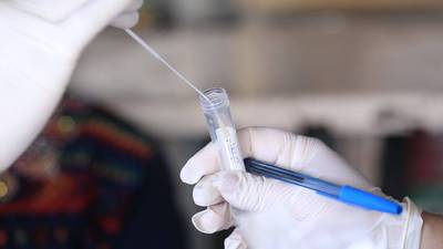País acumula 117 mil 757 casos de Coronavirus