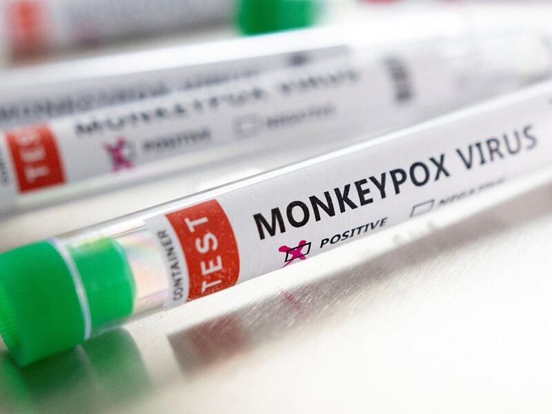 Suman 397 casos acumulados de viruela del mono