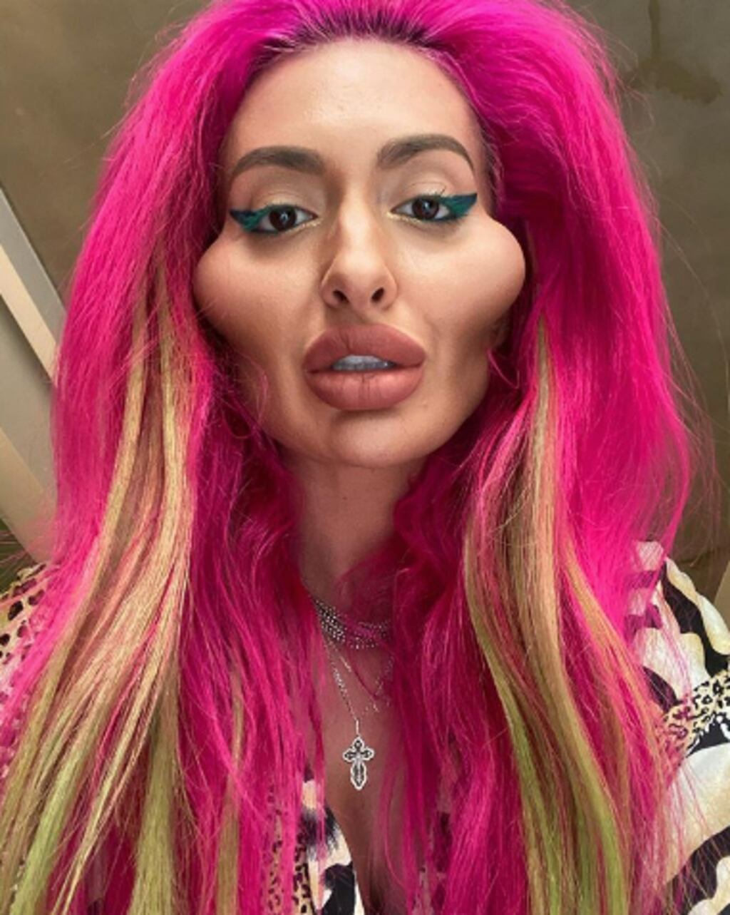 FOTOS. Conoce a la mujer con los pómulos más grandes del mundo Publinews