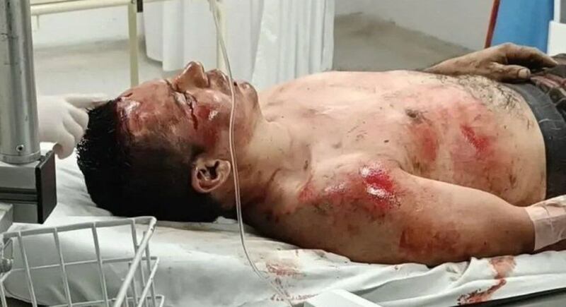 Pastor es linchado en Colombia por grotesco crimen contra un menor ¿Qué fue lo que hizo?