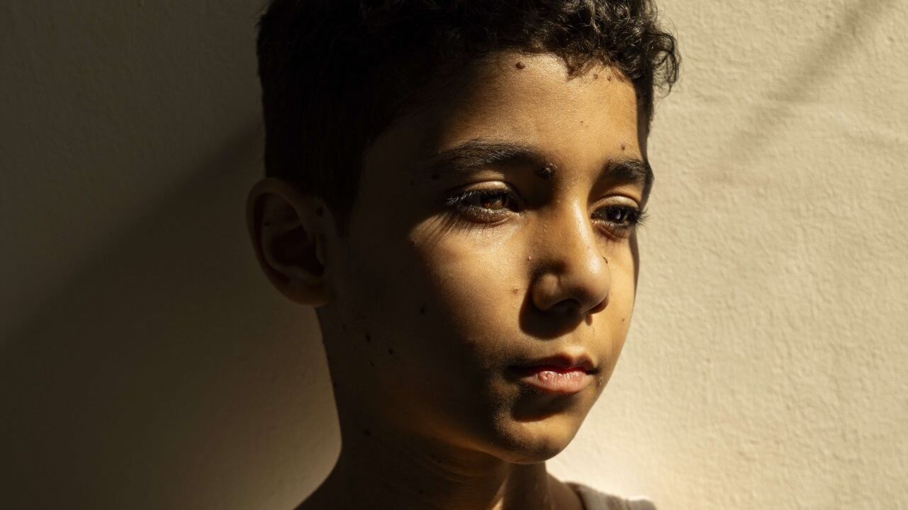 Fotografía ganadora del World Press Photo 2025.