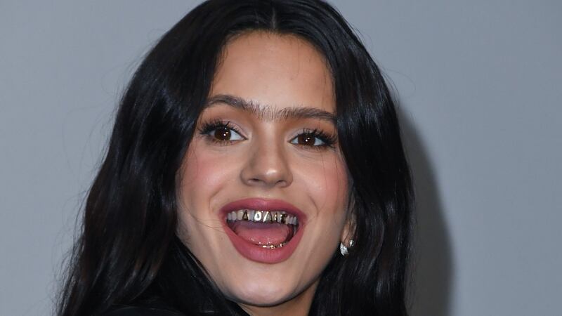 Rosalía publica foto sin blusa, pero la atención se desvía a sus “raros” pies