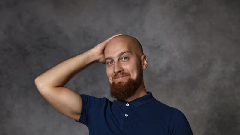 ¡Hoy se conmemora el Día Mundial de los Calvos!