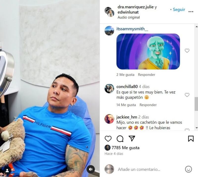 Edwin Luna presume sus "arreglitos" en el rostro y le llueven memes