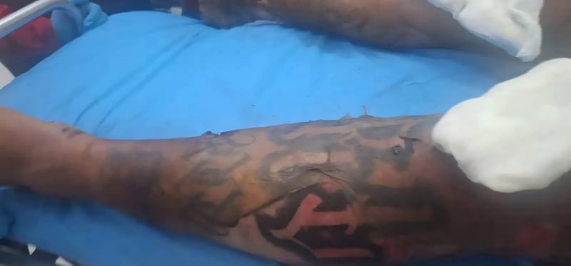 La víctima presentaba tatuajes en todo el cuerpo. Foto: RRSS