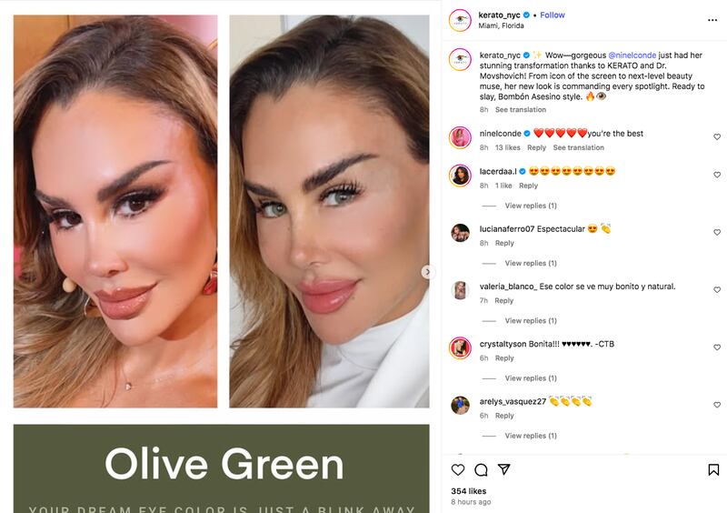 Clínica Kerato sobre el cambio de imagen de Ninel Conde