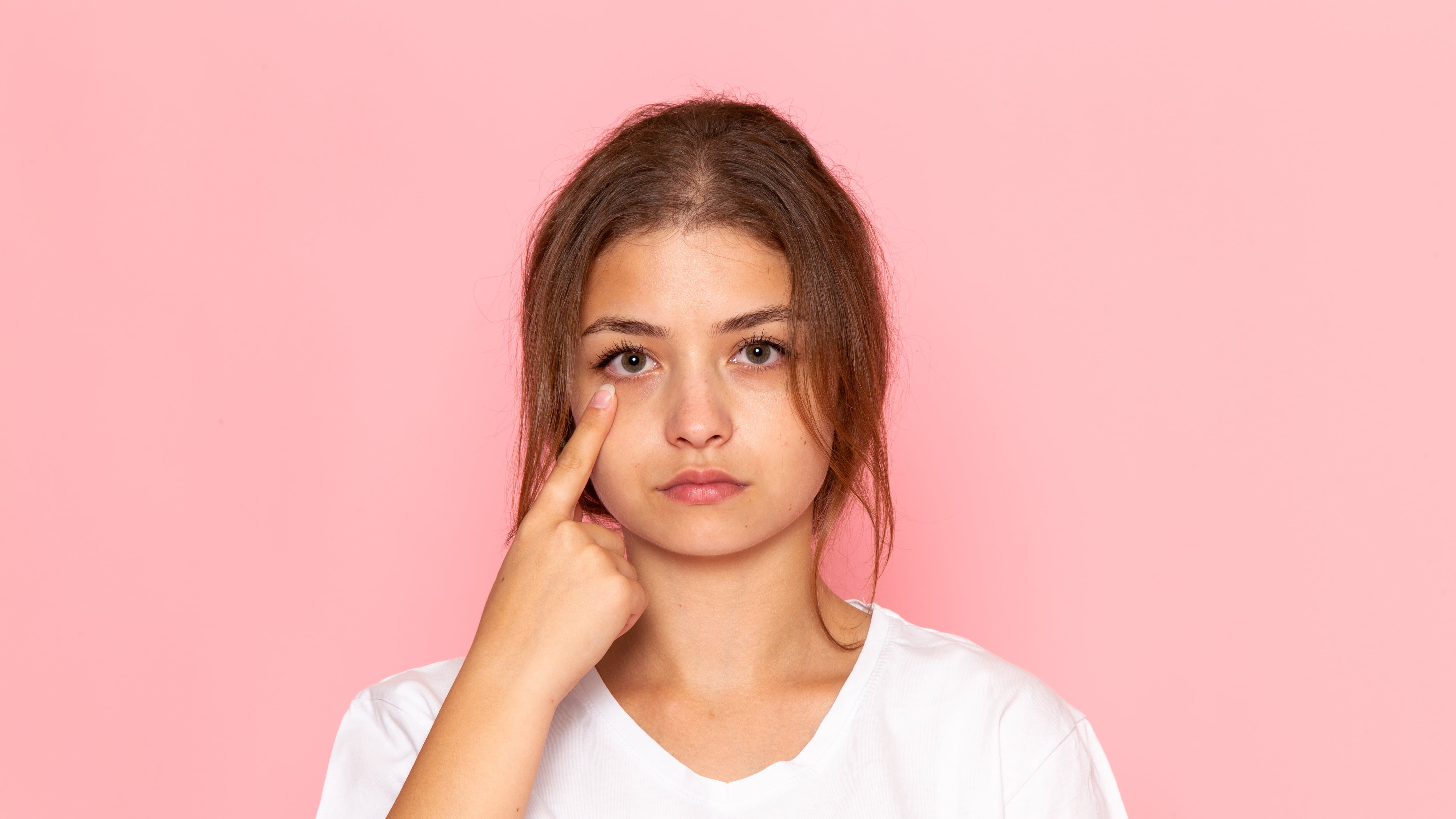 Las ojeras son una de las preocupaciones estéticas más comunes, ya que pueden afectar significativamente a la apariencia de una persona, otorgándole un aspecto cansado o envejecido. Foto: Freepik.