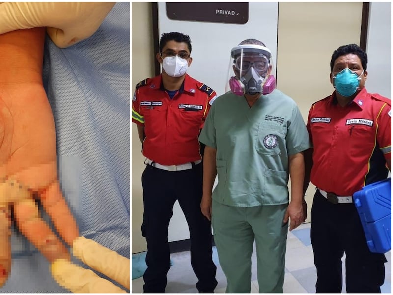 Carnicero sufre accidente con molino; médicos del Hospital San Juan de Dios le reconstruyen la mano