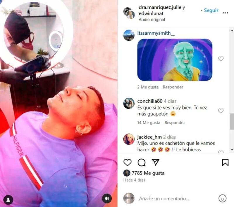 Edwin Luna presume sus "arreglitos" en el rostro y le llueven memes