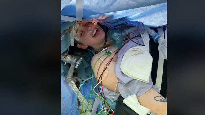 La mujer mostró en su TikTok el video de ella cantando durante su cirugía cerebral