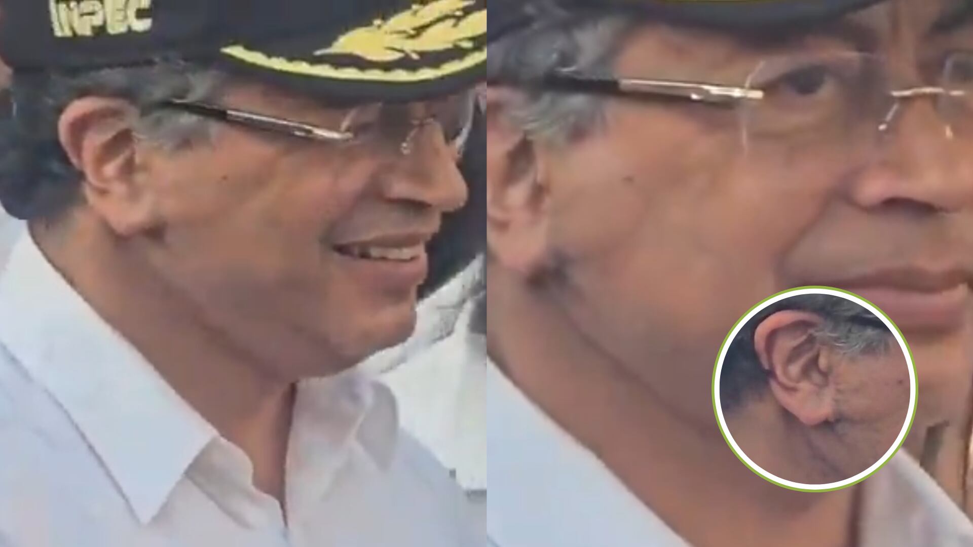 “Quedó mas remendado que una lechona tolimense”: burlas en redes sociales por el resultado de la operación de Petro