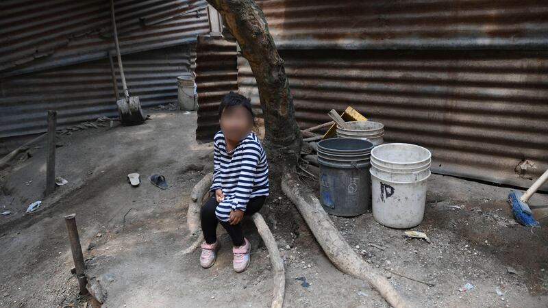 Este año han muerto dos niños por desnutrición aguda, según ministerio de Salud