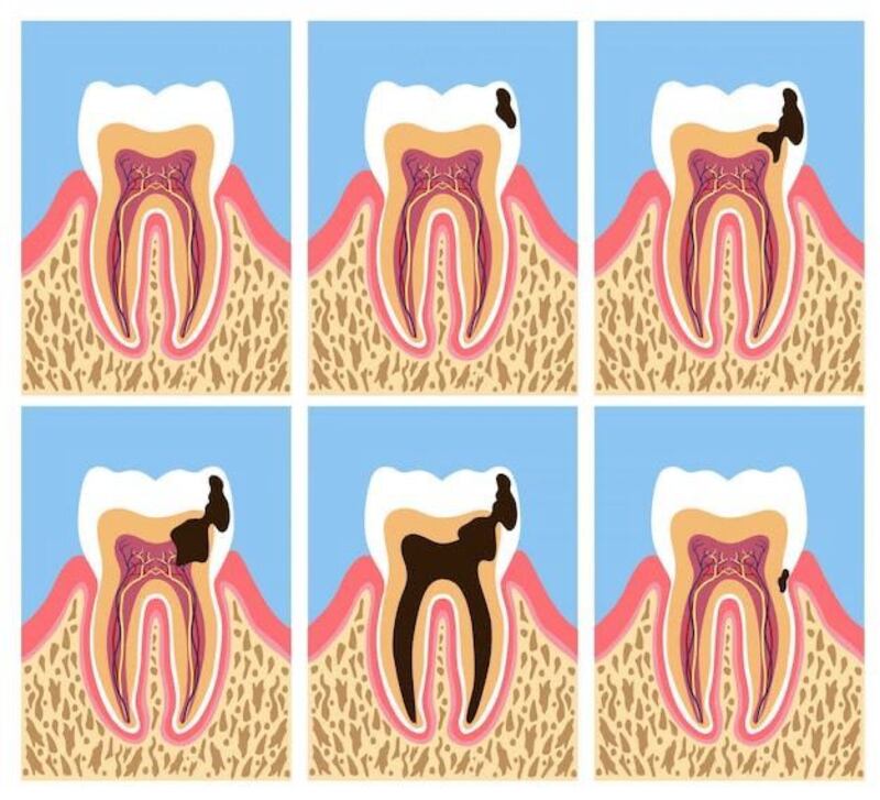 Descuidar tu higiene dental puede traerte más problemas de los que imaginas.