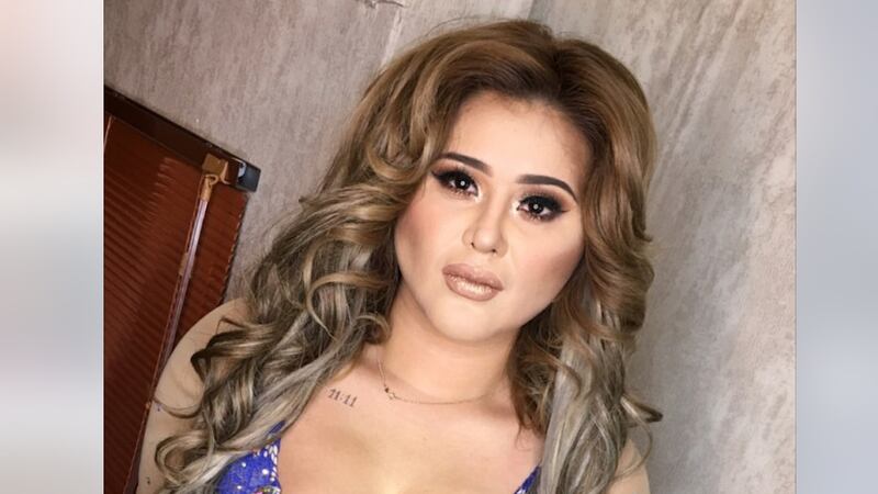 Gomita confiesa y muestra los graves golpes que le propició su padre en el rostro