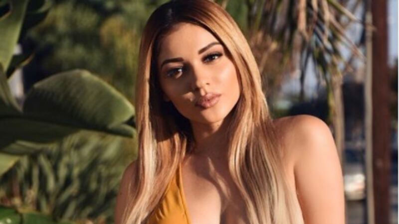 Modelo guatemalteca revela los duros comentarios que recibió tras declararse homosexual con una foto