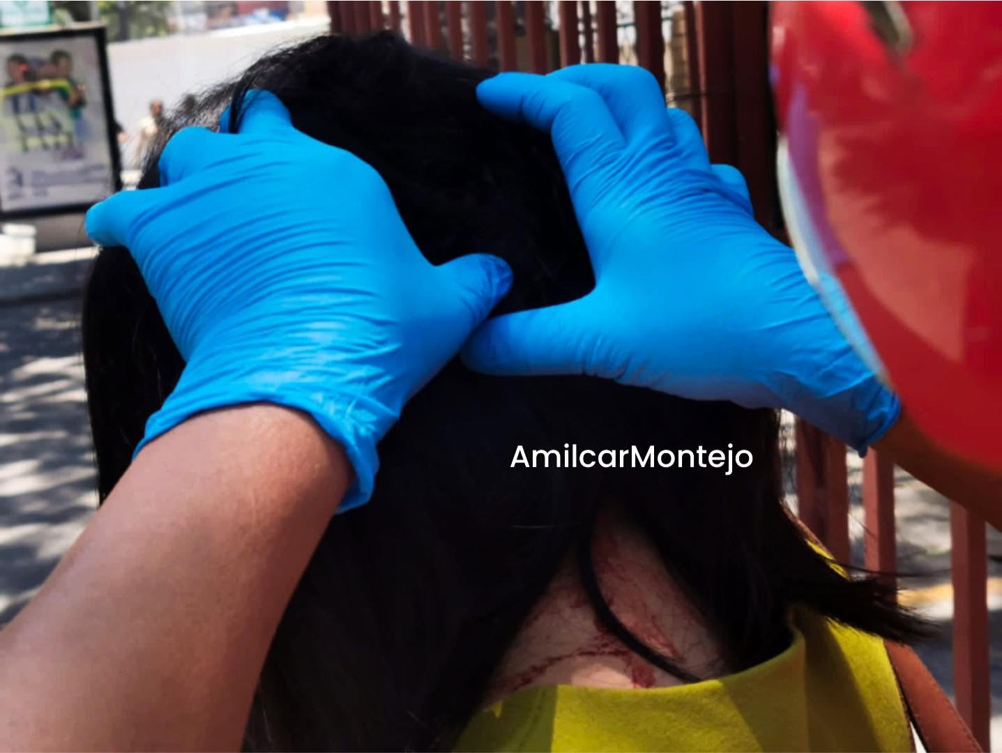 De no creer: pájaro hiere a una mujer con un picotazo en la Avenida Petapa