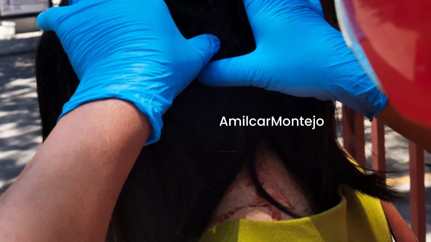 Mujer es atacada por un pájaro en la Avenida Petapa. Foto: Amilcar Montejo