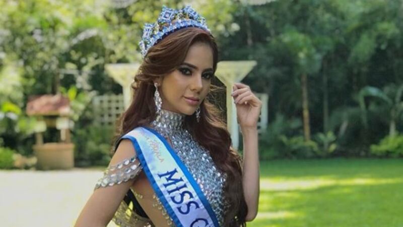 Por esta foto fanáticos afirman que la Miss Mundo Guatemala se operó el busto