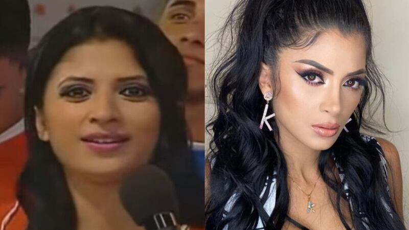 ¿Se operó los senos también? Foto delataría retoque se hizo Kimberly Flores