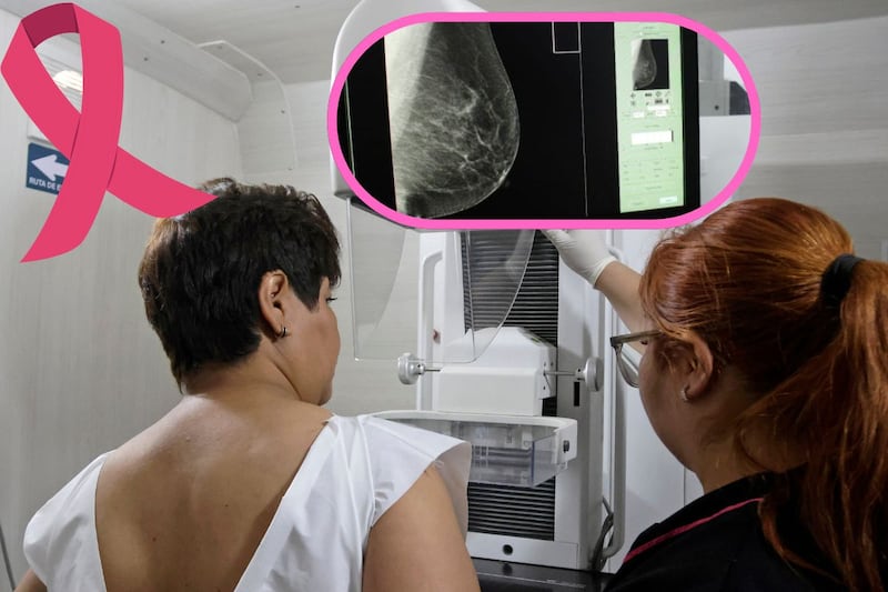 Cáncer de mama.