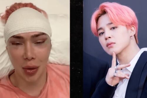 Cantante recibe amenazas tras cirugía para lucir como Jimin de BTS