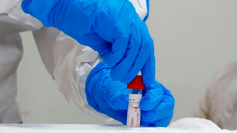 TV Azteca Guate reporta caso positivo de Covid-19 en un trabajador