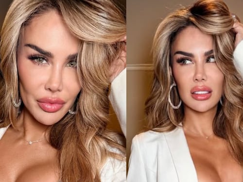 Ninel Conde cambia el color de sus ojos en una costosa cirugía: ¿Cuánto pagó?
