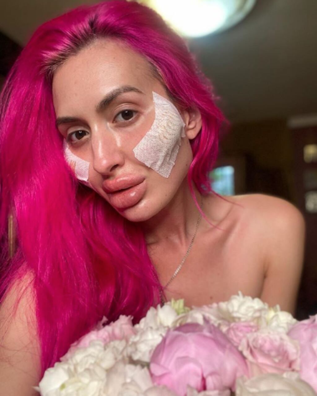 FOTOS. Conoce a la mujer con los pómulos más grandes del mundo Publinews