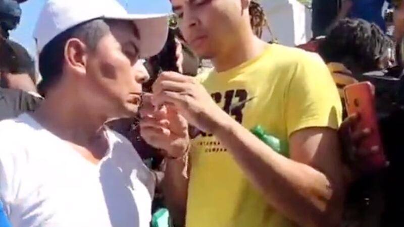 VIDEO. Migrantes se cosen la boca en protesta en Tapachula