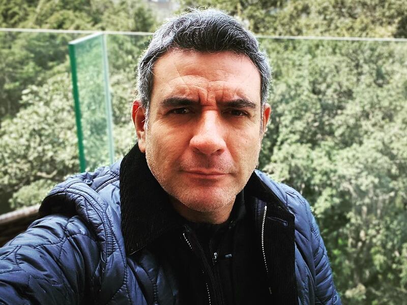 ¡Irreconocible! Héctor Sandarti presume resultado de su cirugía estética