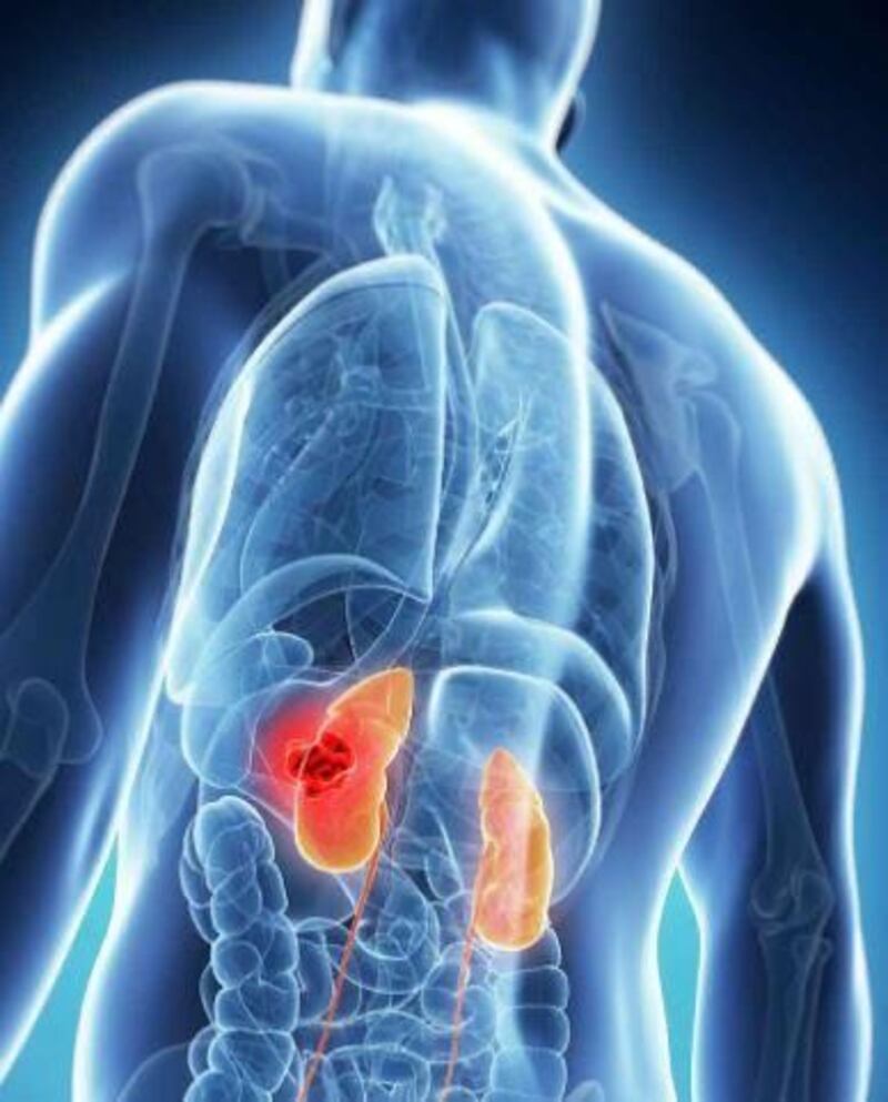 Guatemala da el primer paso contra una epidemia silenciosa
Lidera propuesta en la OMS para priorizar la Enfermedad Renal Crónica