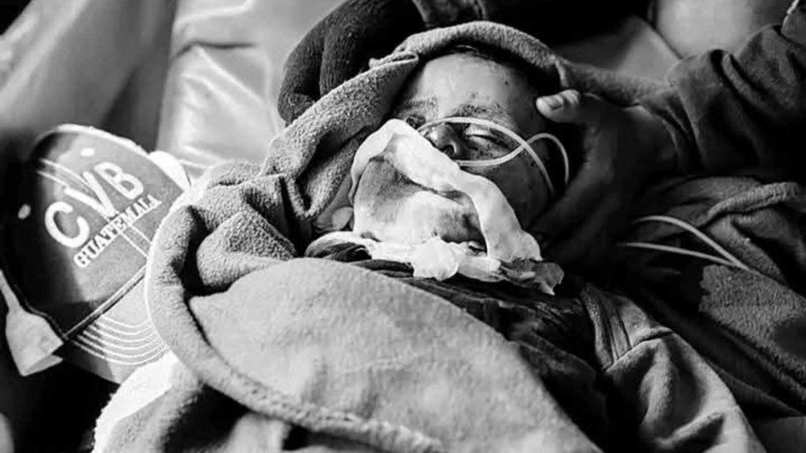 Menor es atacado por un cerdo en San Martín Jilotepeque.