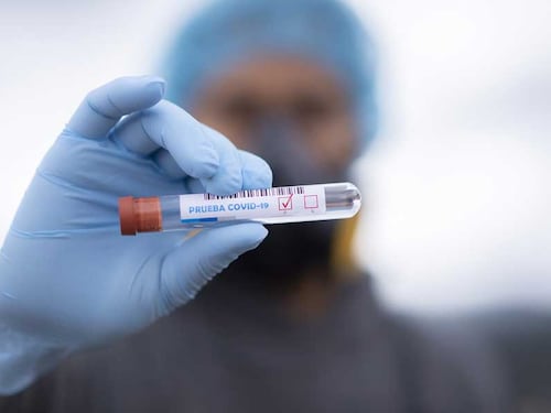 Casos positivos acumulados de coronavirus ascienden a 49 mil 789, según tablero de Salud