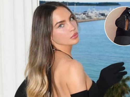 Belinda sufre grave lesión, ¿pone en riesgo su participación en “Mentiras El Musical”?