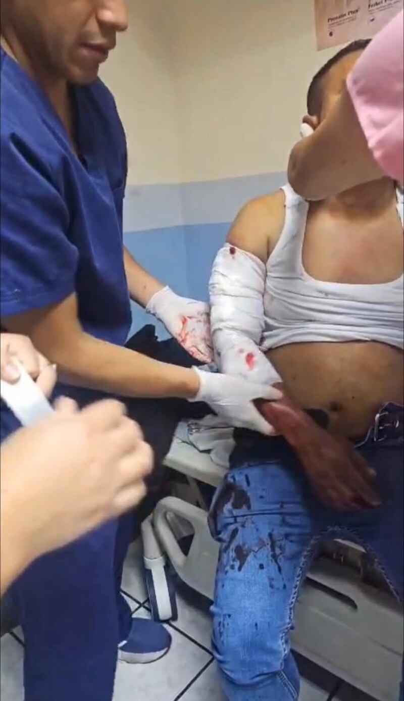 Esposa de un diputado es víctima de ataque armado en Carretera a El Salvador