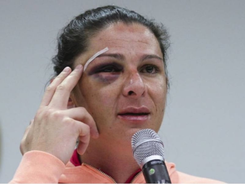 Agresor de Ana Guevara queda en libertad tras brutal golpiza