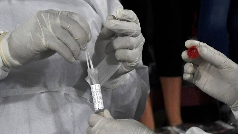 Personal de Sesan es enviado a cuarentena tras confirmarse caso de Covid-19 en la institución