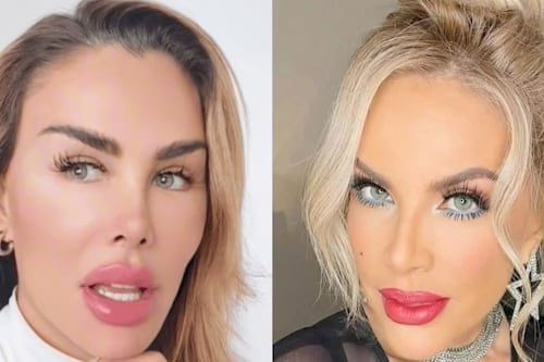 Lorena Herrera arremete contra Ninel Conde tras promover el uso de cirugías estéticas