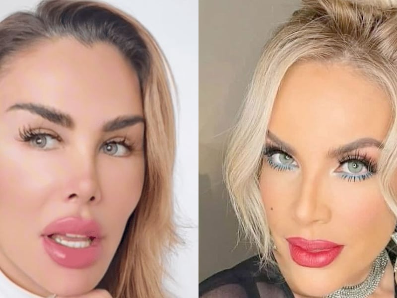 Lorena Herrera arremete contra Ninel Conde tras promover el uso de cirugías estéticas