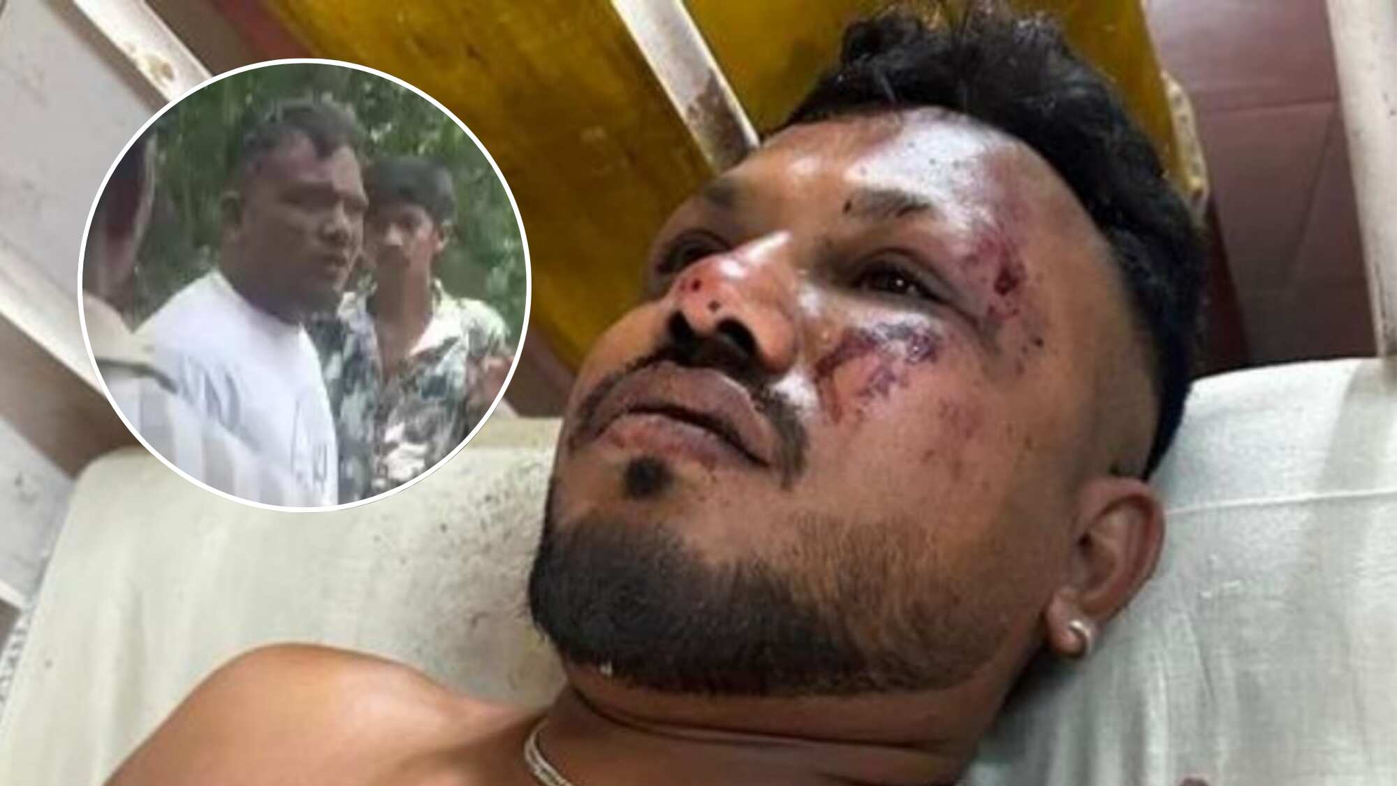 "Todo sucedió muy rápido": Habla el único sobreviviente del accidente aéreo en India