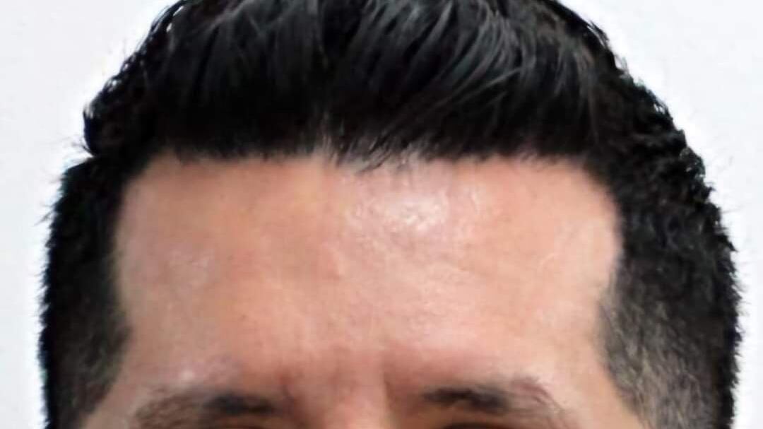 Víctima de ataque armado.