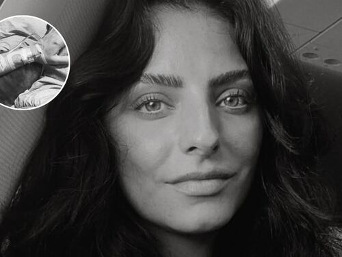 Aislinn Derbez comparte alarmante fotografía y explica cuál es su estado actual